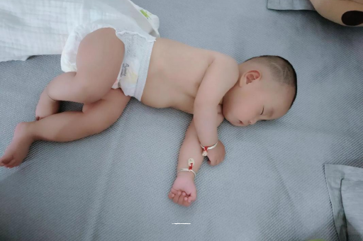 敦煌宝宝头上长痱子 敦煌宝宝头上长痱子